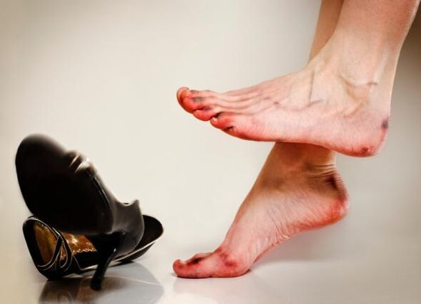 O desenvolvemento de fungos nas unhas dos pés pode ser causado por zapatos demasiado axustados